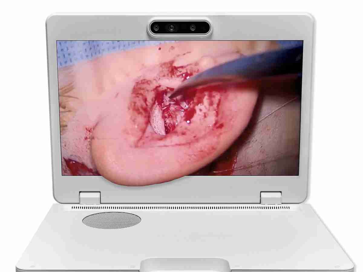 达擎之＂Heads-up 3D显微手术显示系统＂，，，整合4K裸眼3D显示及眼球追踪系统，，，，具备快速追踪人眼移动位置功能，，，，减轻医师长时间维持固定姿势的负担，，，让医师能有更宽广清晰的3D立体视野及更舒适的姿势来执行手术。。